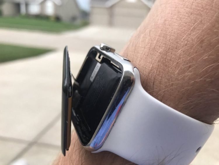 apple-watch-swollen-800x600.jpg