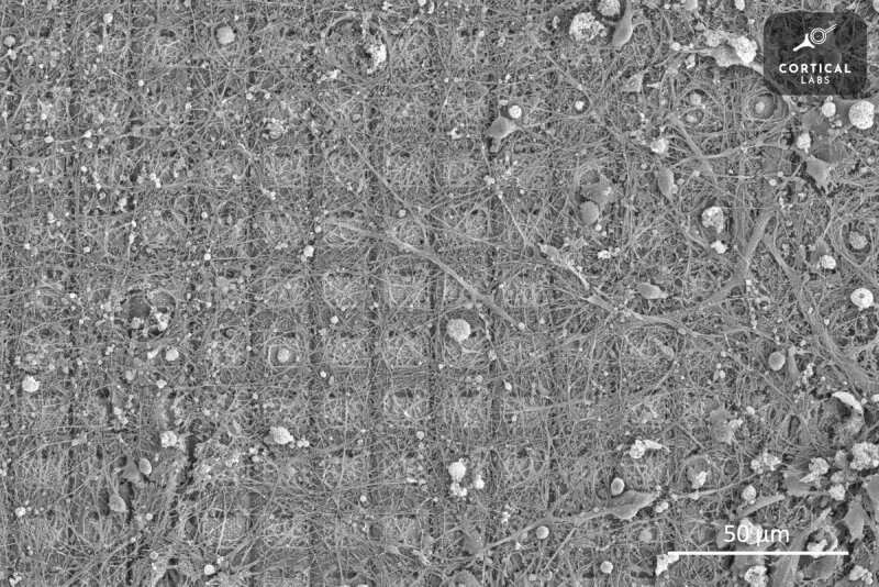 sm.electron-microscope-image-of-dish-bain-neurons.800.jpg