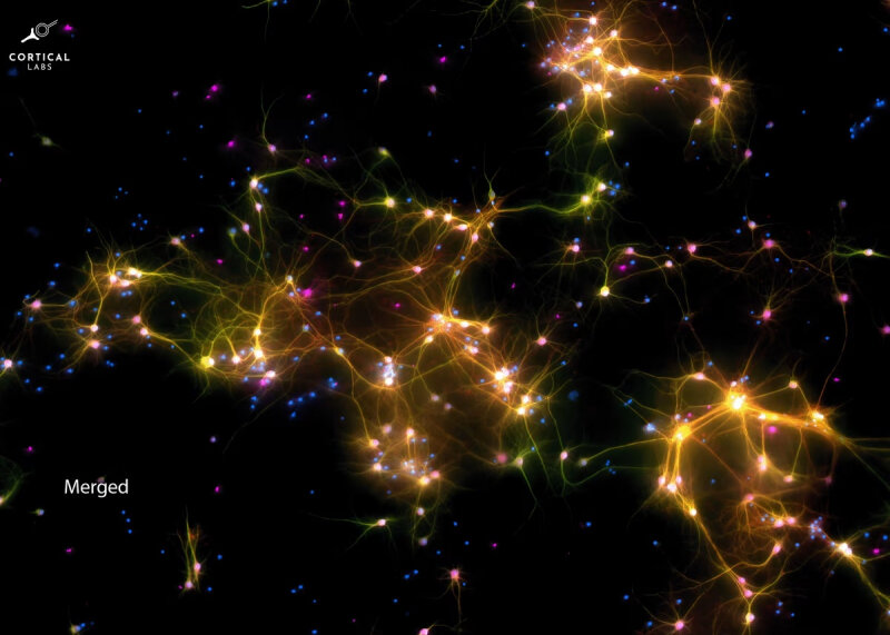 sm.microscope-image-of-neurons-within-dish-brain-cells-highlighted.800.jpg