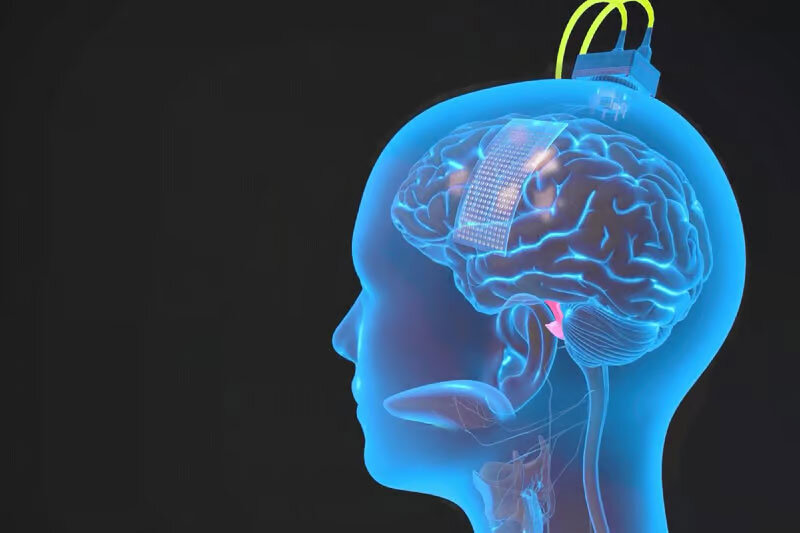 brain_02.jpg