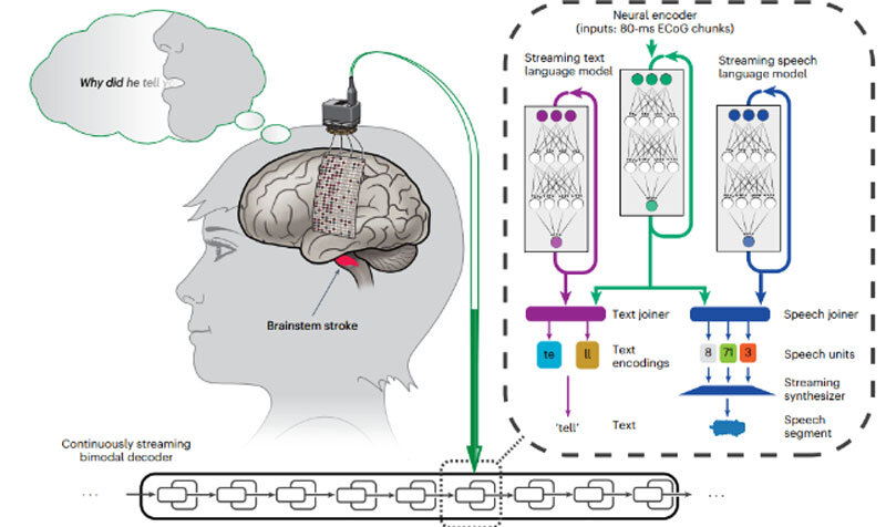 diagram_bci_speech_642.jpg